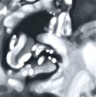 KITO JEMPERE / OBJECTS REMIXES EP1 (HNNY / JACQUES RENAULT / INKSWEL REMIXES)